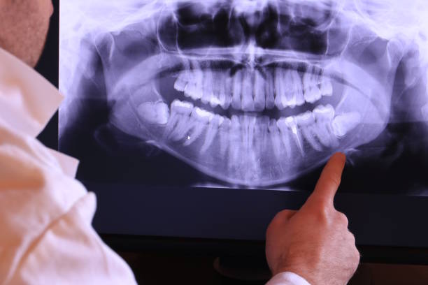 Best Broken or Cracked Tooth Emergency Dentist in Pemberville, OH