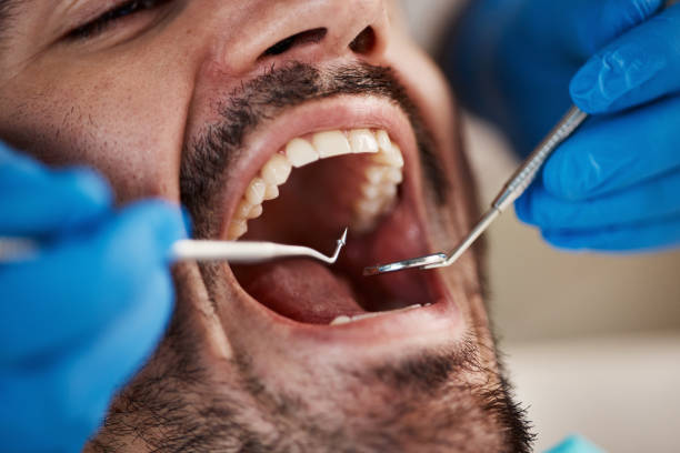Best Emergency Dental Extractions in Pemberville, OH